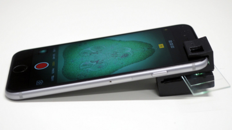 Di Tangan Ilmuwan, Ponsel Bisa jadi Mikroskop