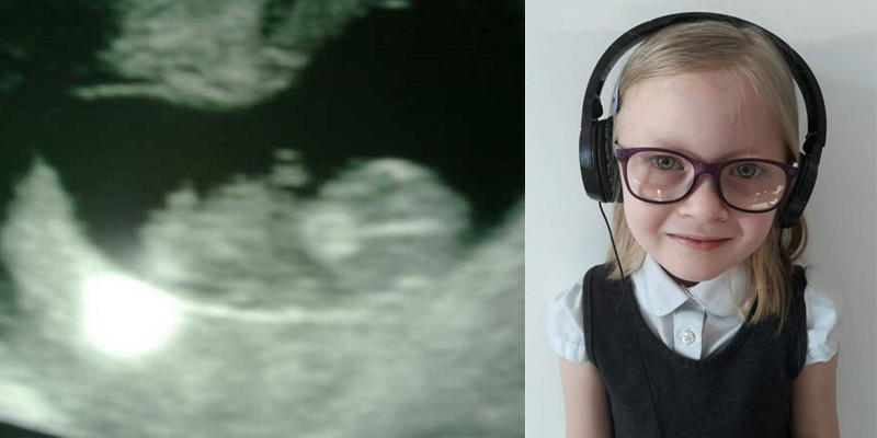 Ibu Ini Kaget, Bayi di Dalam Rahimnya Pakai “Headphone”