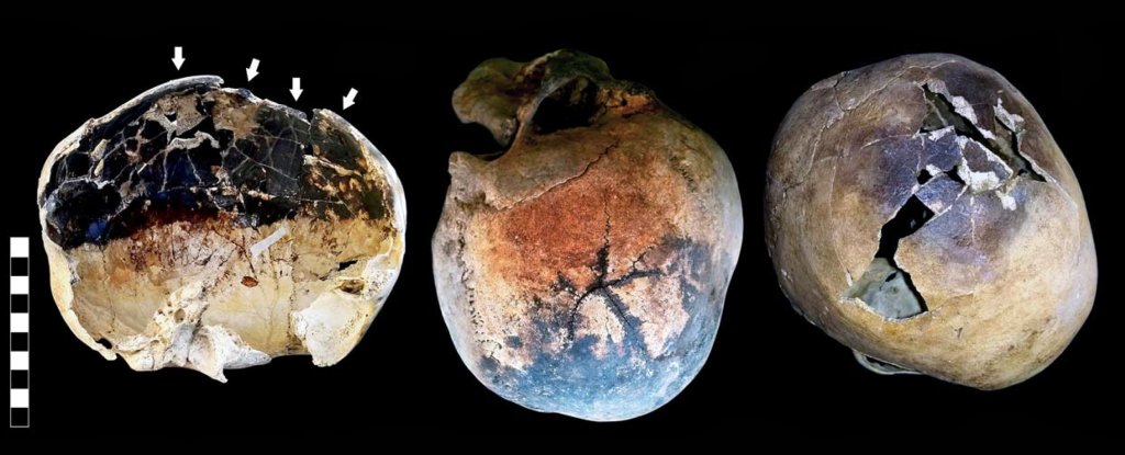 Ngeri! Letusan Gunung Vesuvius Mendidihkan Darah dan Otak