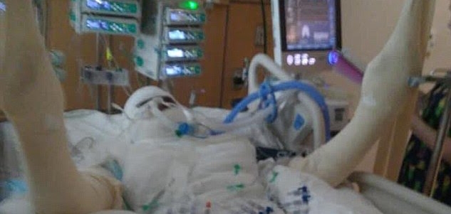 Gila! Ingin Terkenal di YouTube, Banyak Remaja Bakar Diri