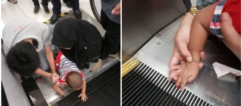 Viral Foto Anak Terjepit Eskalator, Bikin Ngeri!