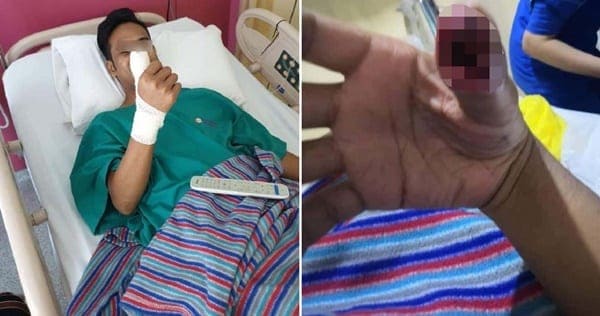 Tempered Glass Retak