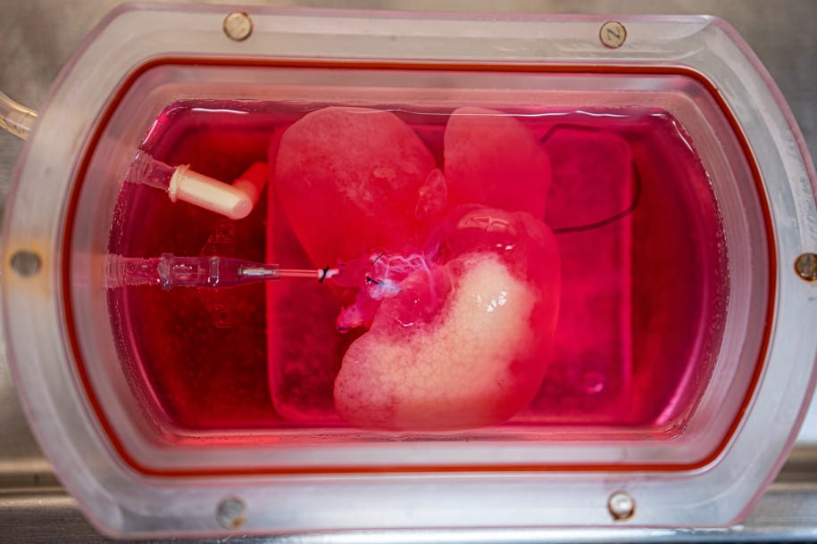 Hati Manusia Ditransplantasi Jadi Tikus