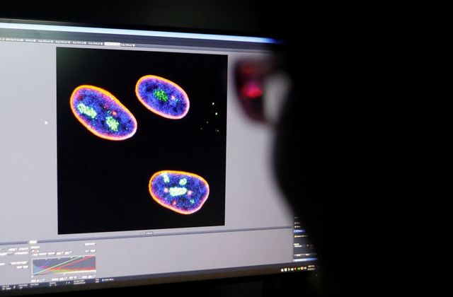 Ilmuwan China Kembangkan Terapi Gen Penunda Penuaan Dini