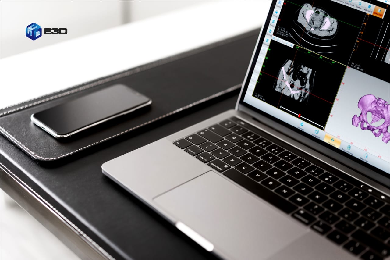 Melihat Penerapan Teknologi 3D Printing di Bidang Medis