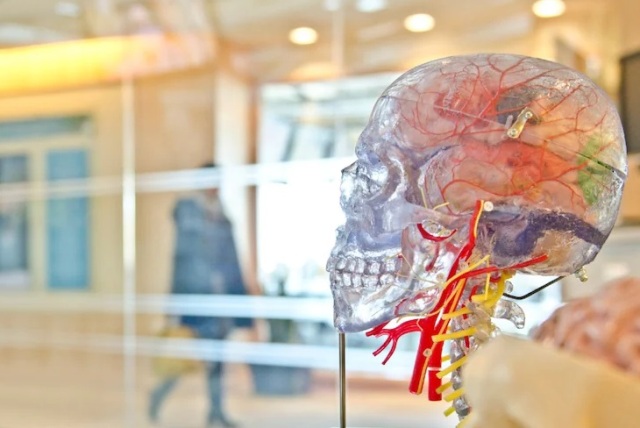 Algoritma AI bantu obati epilepsi