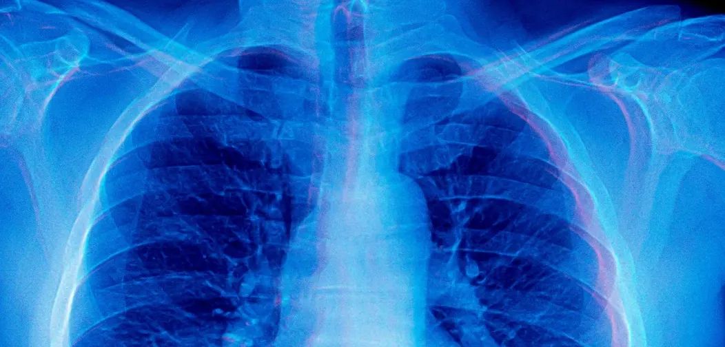 Ilustrasi model AI frontier yang menghasilkan deskripsi gambar medis palsu tanpa akses visual, menunjukkan fenomena mirage reasoning.