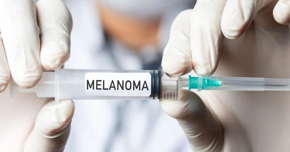 Ilustrasi vaksin mRNA personal untuk terapi kanker melanoma di laboratorium