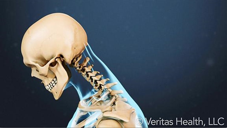 Text Neck