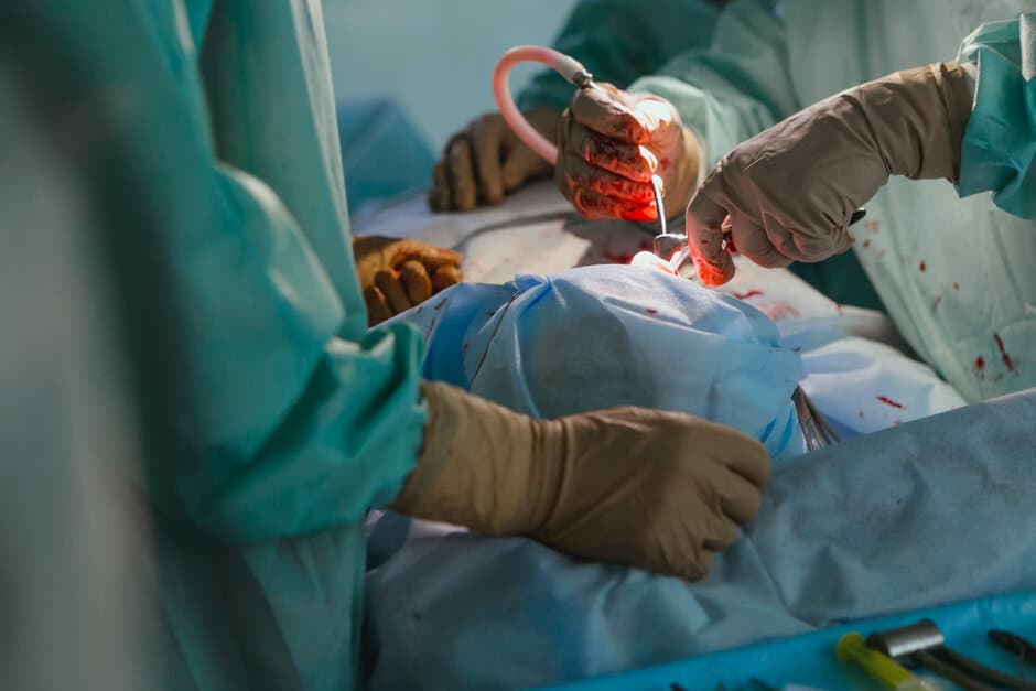 Apple Watch Jantung akut