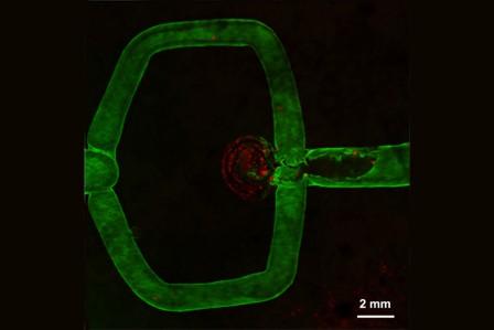 Ilmuwan Cetak 3D Aneurisma Otak Hidup Pertama di Dunia