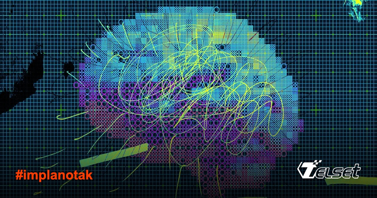 Ilustrasi implan otak dan data neural yang rentan dieksploitasi