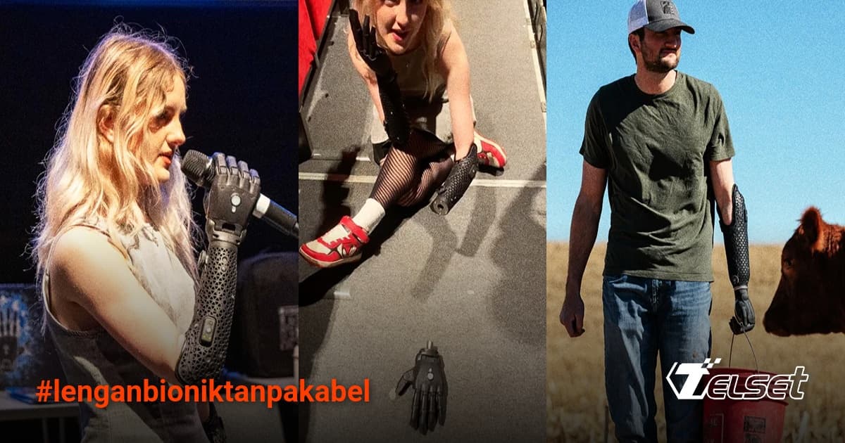 Tangan bionik Hero dari Open Bionics yang sedang merangkak sendiri