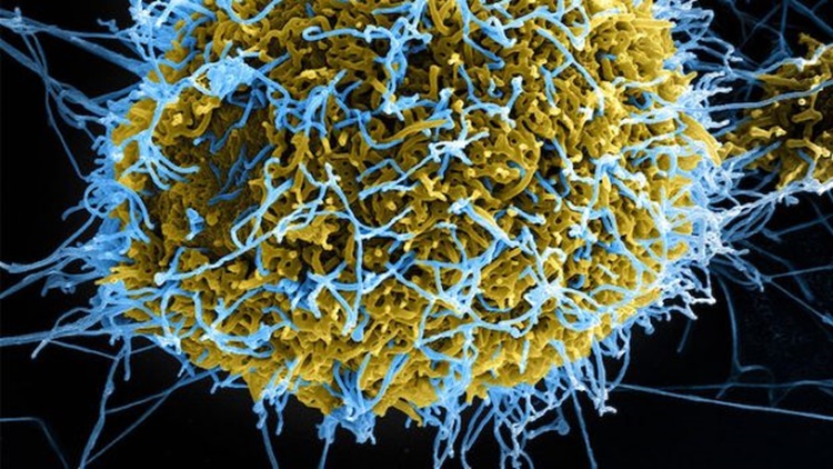 lymphocytic choriomeningitis virus