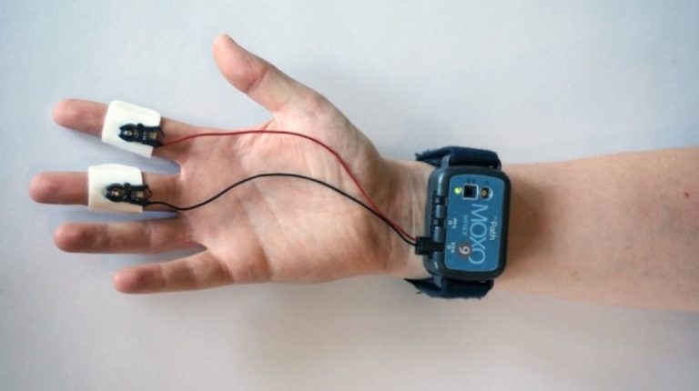 Gelang Ini Dapat Deteksi Emosi Penggunanya