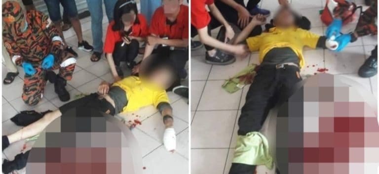 Apes, Pemuda Ini Babak Belur Dikeroyok Gara-gara Selfie