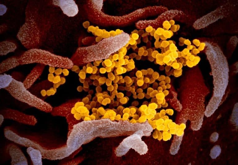 Gambar Virus Corona Dirilis Peneliti AS, Begini Wujudnya