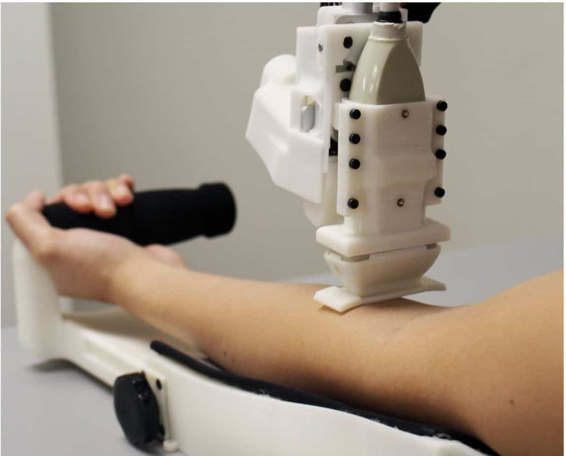 Hasil gambar untuk Kalahkan Manusia, Robot Ini Cekatan Lakukan Teknik “Venipunktur”