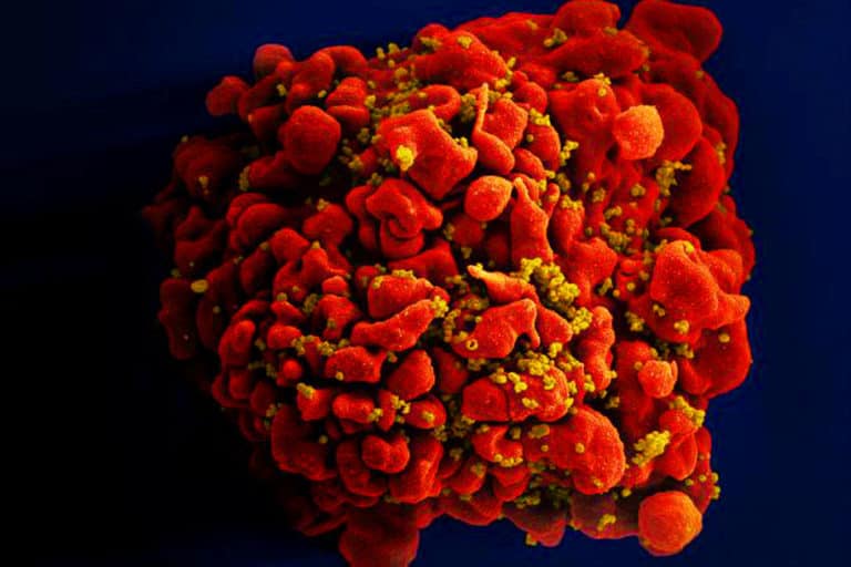 Pasien HIV