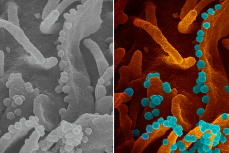 Ngeri! Virus Corona ‘Melahap’ Sel Inang Terekam Mikroskop
