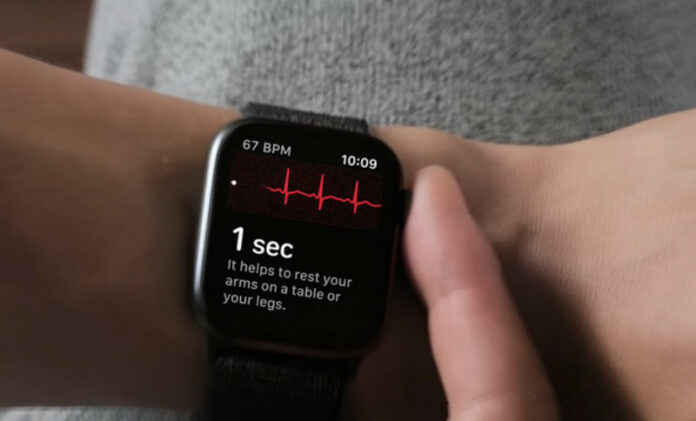 EKG Apple Watch