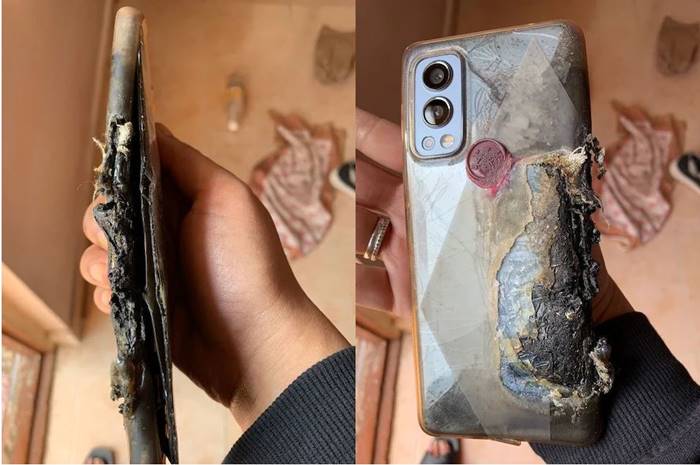 OnePlus Nord 2 Meledak di Saku Celana, Remaja Alami Luka Serius
