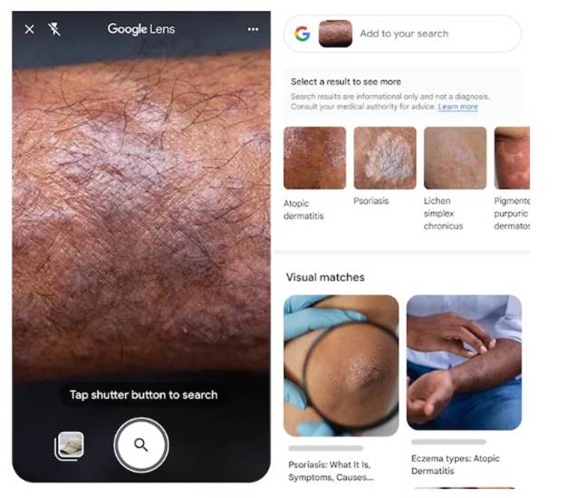 Google Lens Deteksi Kulit Pengguna 