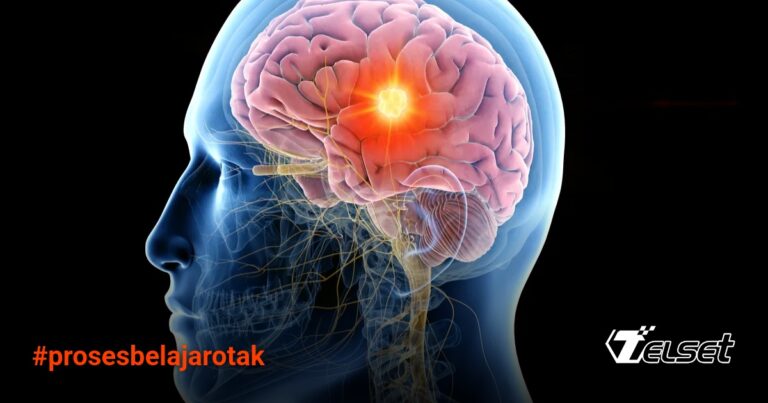 Otak Belajar Lebih Cerdas dari yang Kita Kira, Studi Terbaru Ungkap
