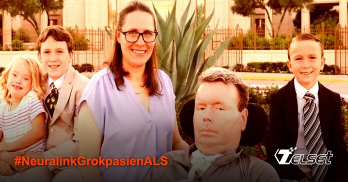 Bradford Smith pasien Neuralink menggunakan Grok untuk komunikasi