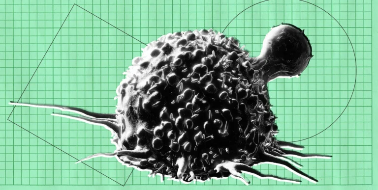 AI Deteksi Kanker Justru Turunkan Kemampuan Dokter